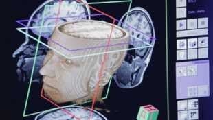 La fabrique du cerveau